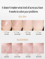 Acne Removing Salicylate Products - Image 6