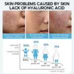Hyaluronic Acid Face Serum Anti-Aging Shrink Pore Whitening Moisturizing Face Cream Dry Skin Care - Image 6